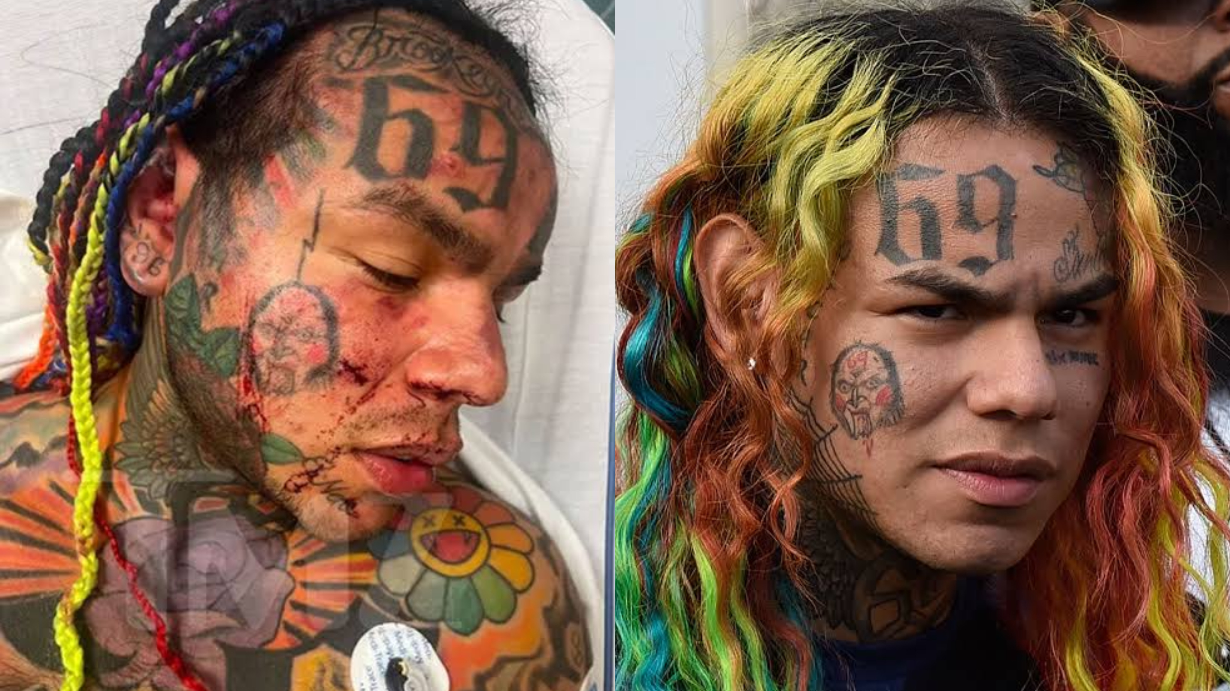 Tekashi 6ix9ine Assault Ex Ufc Fighter Makes Massive Claim About